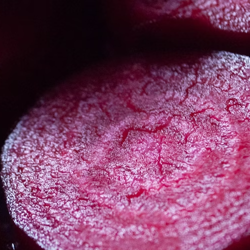 Nitrate Supplementation With Beetroot Juice